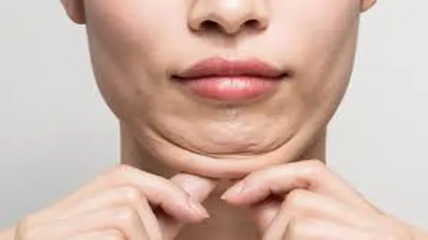 ورزش صورت برای زیبایی